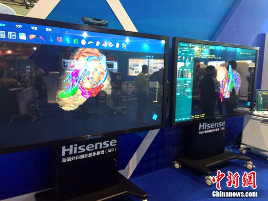 ����CASӋ(j��)��C(j��)�o�����g(sh��)ϵ�y(t��ng)